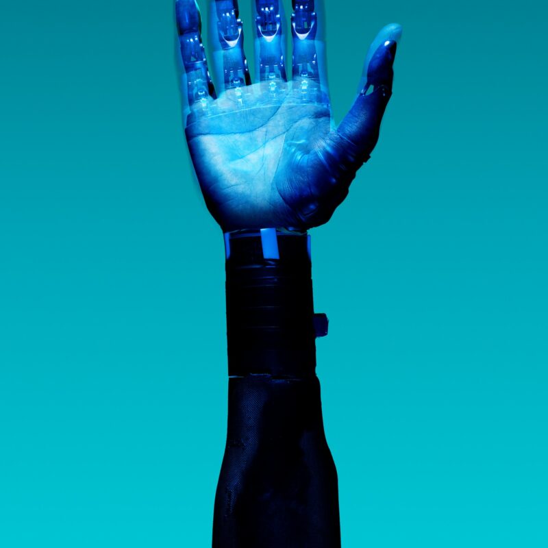 Photograph of bionic tech arm 